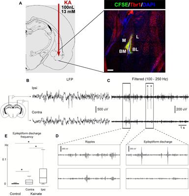 Reactive Disruption of the Hippocampal Neurogenic Niche After Induction of Seizures by Injection of Kainic Acid in the Amygdala